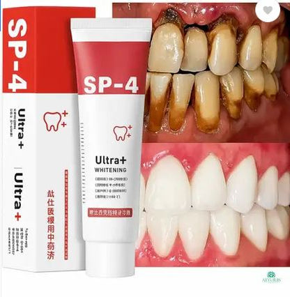 🦷 SP-4 Ultra+ Whitening Toothpaste